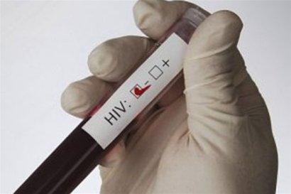 Одесситов приглашают провести бесплатные тест на ВИЧ, вирусные  гепатиты В,С и сифилис