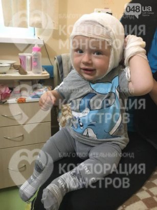 В Одессу доставили ребенка с глубоким ожогом