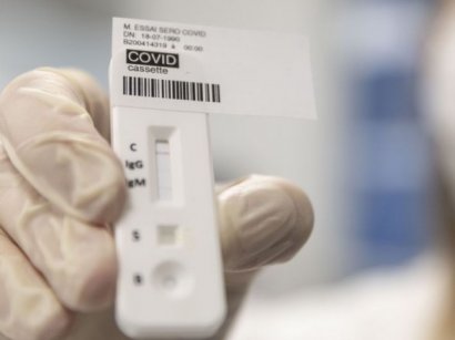 В Минздраве сообщили, сколько в Украине ПЦР-тестов для проверки на коронавирус